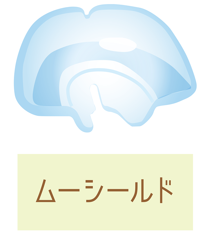 矢口渡・池上・武蔵新田、のびのび歯科・矯正歯科で使用する装置ついての解説