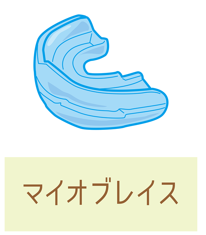 矢口渡・池上・武蔵新田、のびのび歯科・矯正歯科で使用する装置ついての解説