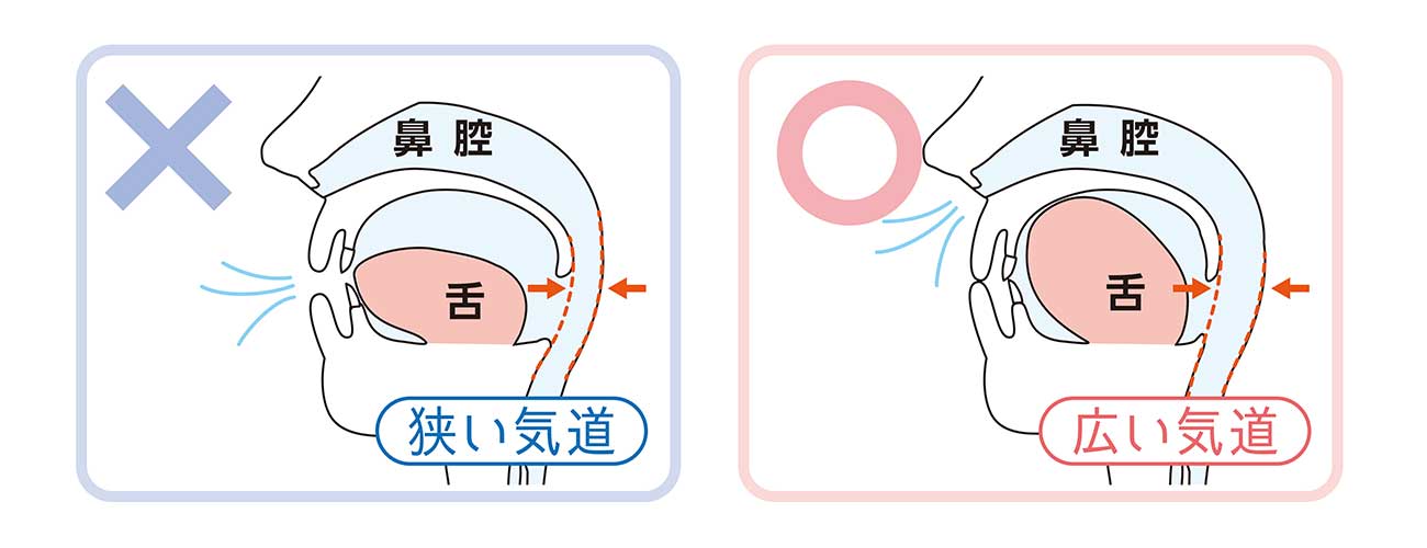 矢口渡・池上・蓮沼・武蔵新田・蒲田の歯医者、のびのび歯科・矯正歯科で子供の成長発育矯正